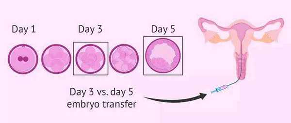 试管移植的时候可以放入多个胚胎吗？